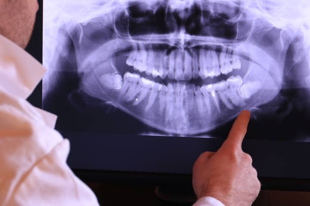 Best Broken or Cracked Tooth Emergency Dentist in Bridgeport, WA
